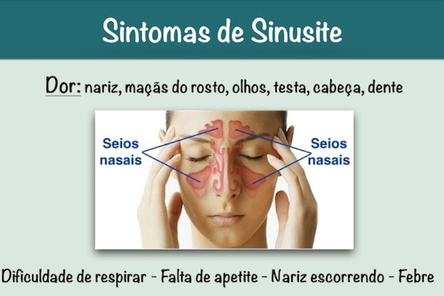 Resultado de imagem para Sintomas de sinusite – Tosse